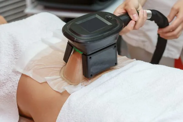 Image of person having fat freezing treatment to help weight gain Skegness