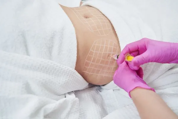image of fat dissolving injections on love handles to help combat weight gain Skegness