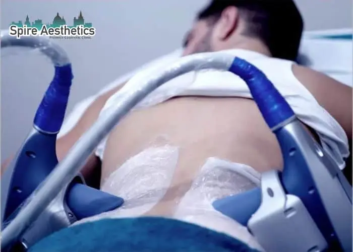 Man having fat freezing treatment done on love handles before a competitions Skegness to create a sculpted look.