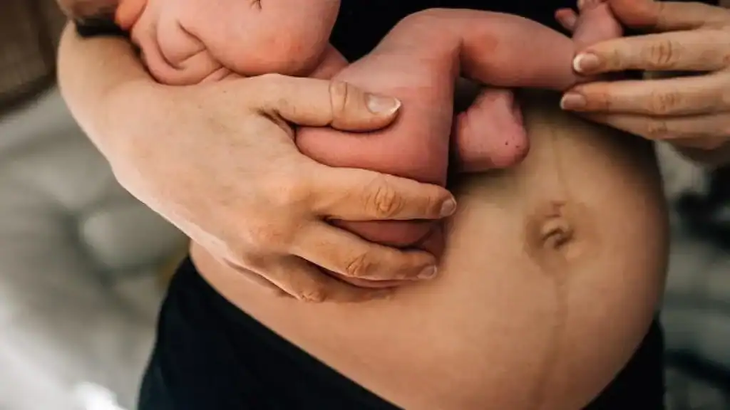 Why Is My Stomach Still Big After Pregnancy Skegness?