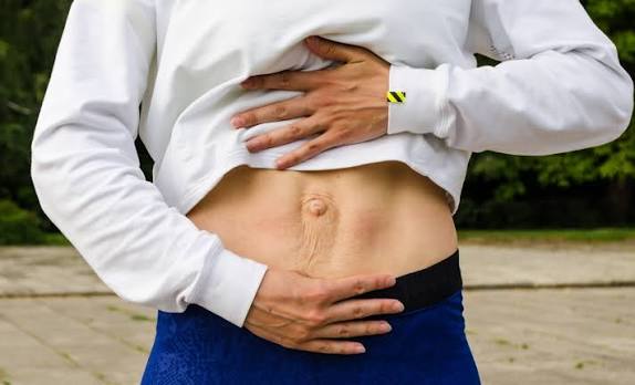 When Could Diastasis Recti Be the Missing Piece of the Puzzle Skegness?